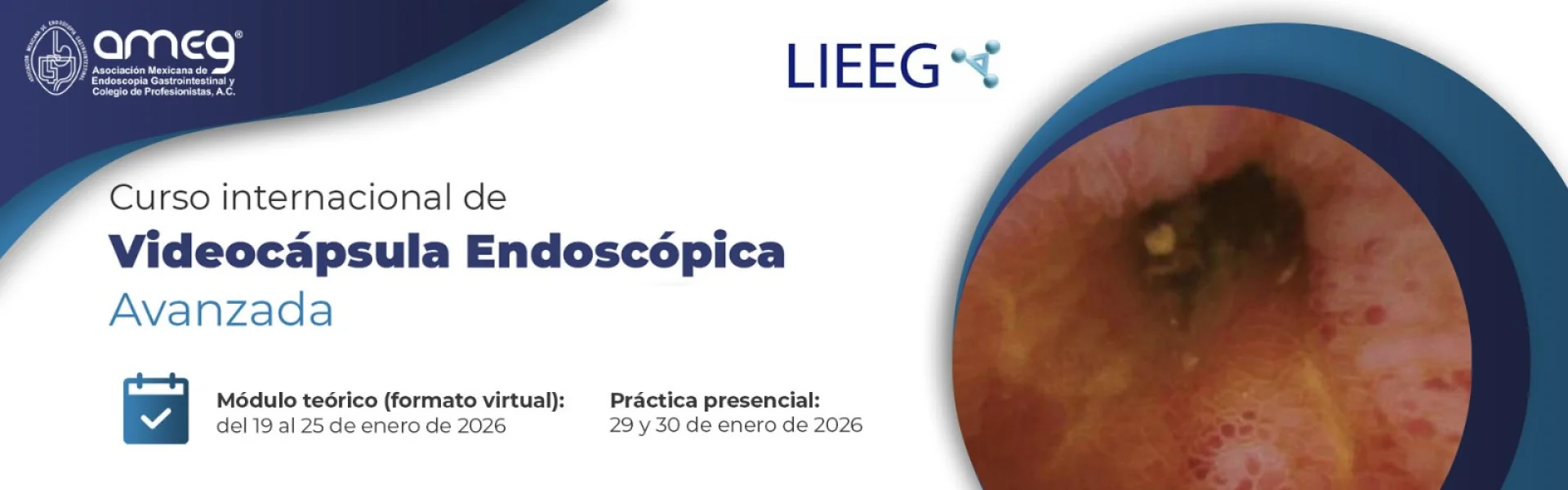 Curso internacional de Videocápsula Endoscópica Avanzada