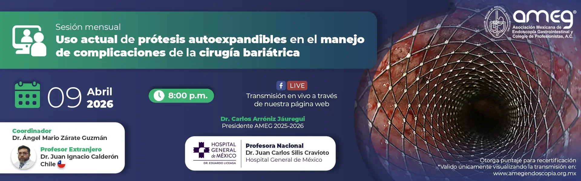 Uso actual de prótesis autoexpandibles en el manejo de complicaciones de la cirugía bariátrica