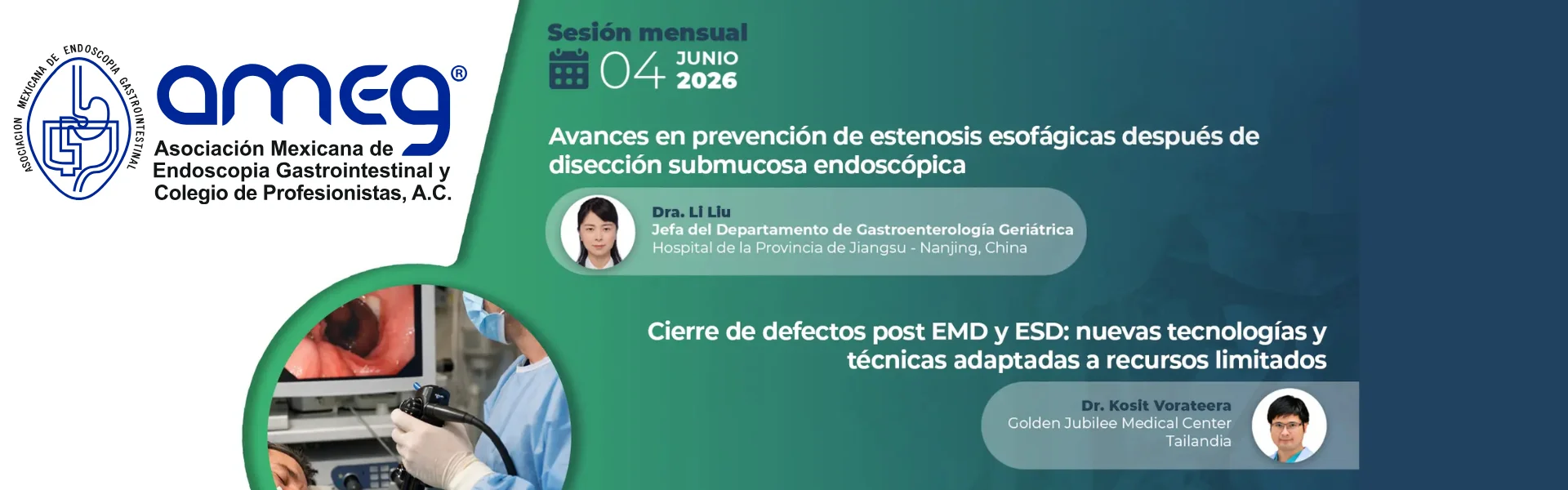 Avances en prevención de estenosis esofágicas después de disección submocosa endoscópica